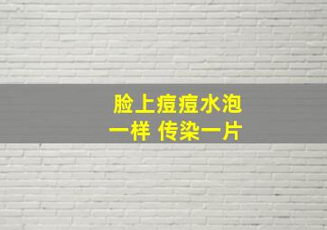 脸上痘痘水泡一样 传染一片